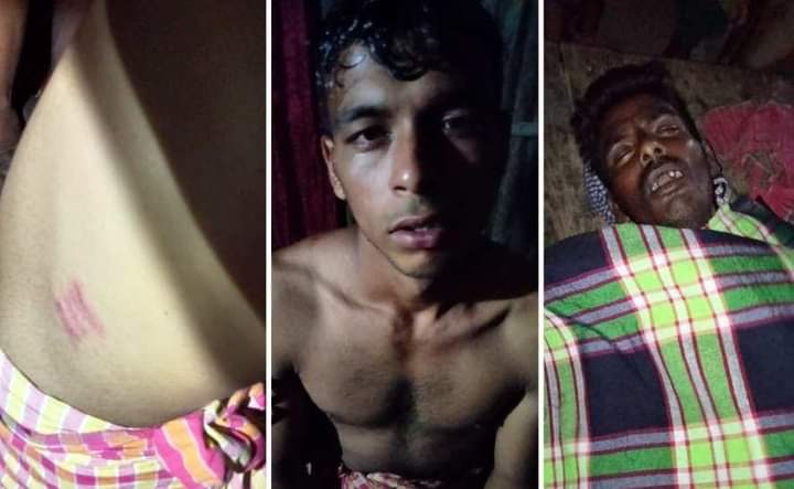 Read more about the article দৌলতপুরে ভাগ্নের উপরে সন্ত্রাসী হামলা দেখে ভয়ে প্রাণ গেল মামার – ভাগ্নে চিকিৎসাধীন