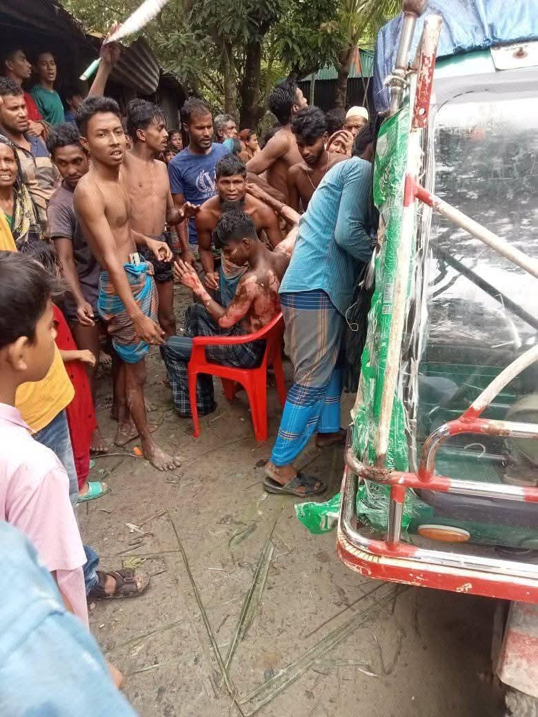 Read more about the article গলাচিপায় ট্রলারে গ্যাস সিলিন্ডার বিস্ফোরণ: অগ্নিদগ্ধ ৫, গুরুতর ২